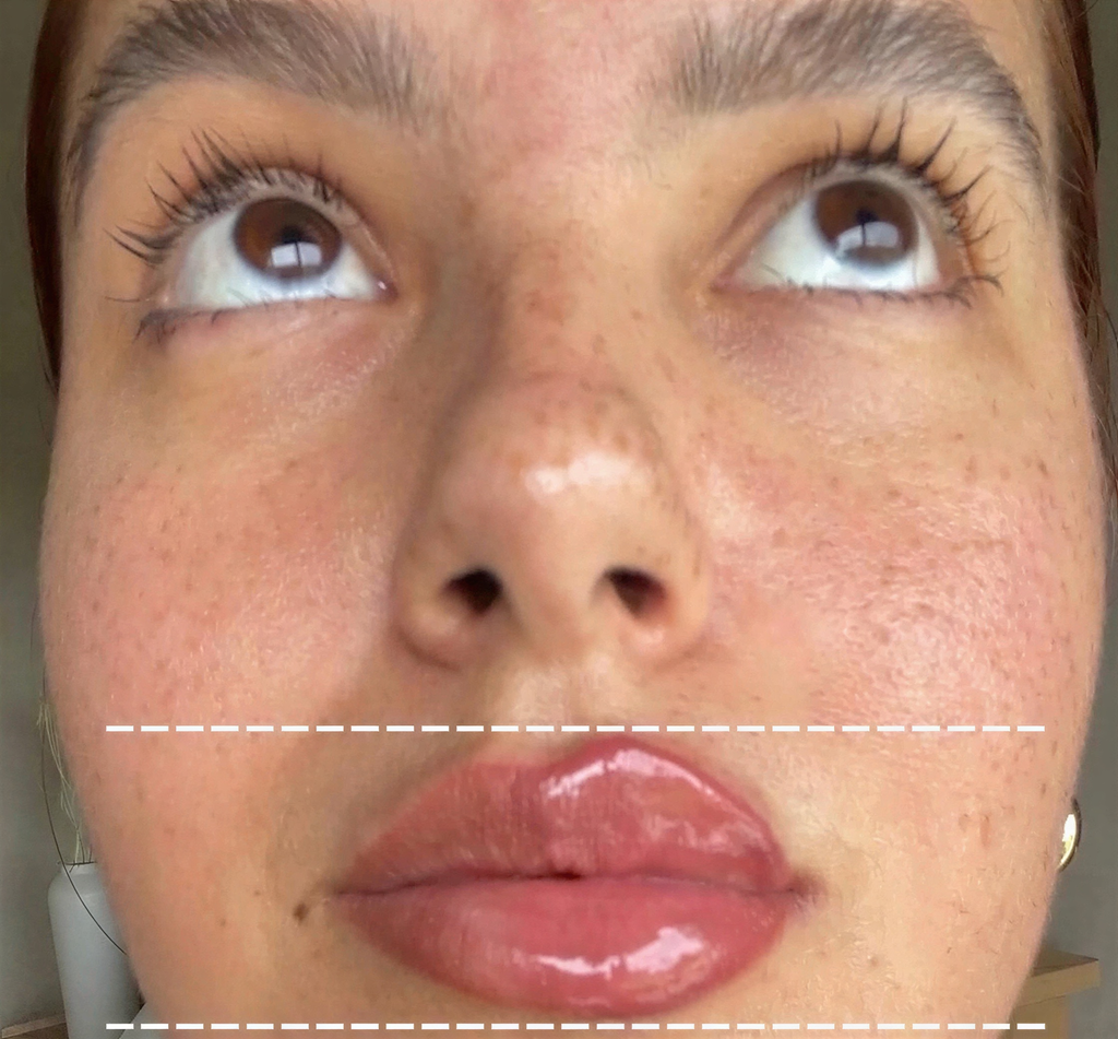 Plumped™ Lip Plumper & Hydrator - 5ml